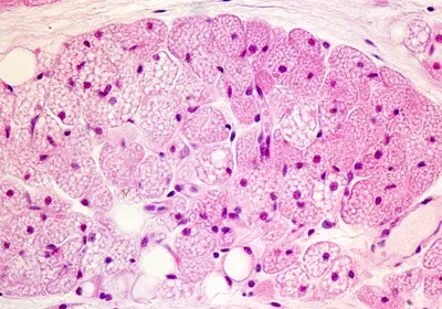 brown fat, metabolism, cardiovascular disease, cardiometabolic disease, genetics & genomics, immunology, Q&A, adipose tissue, obesity 
